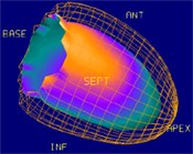 Heart Scan